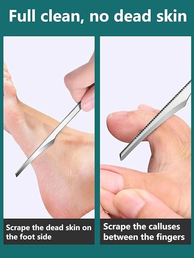 5-Piece Pedicure Knife Set - Stainless Steel with Storage Case