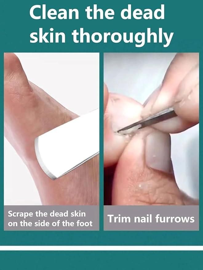 5-Piece Pedicure Knife Set - Stainless Steel with Storage Case