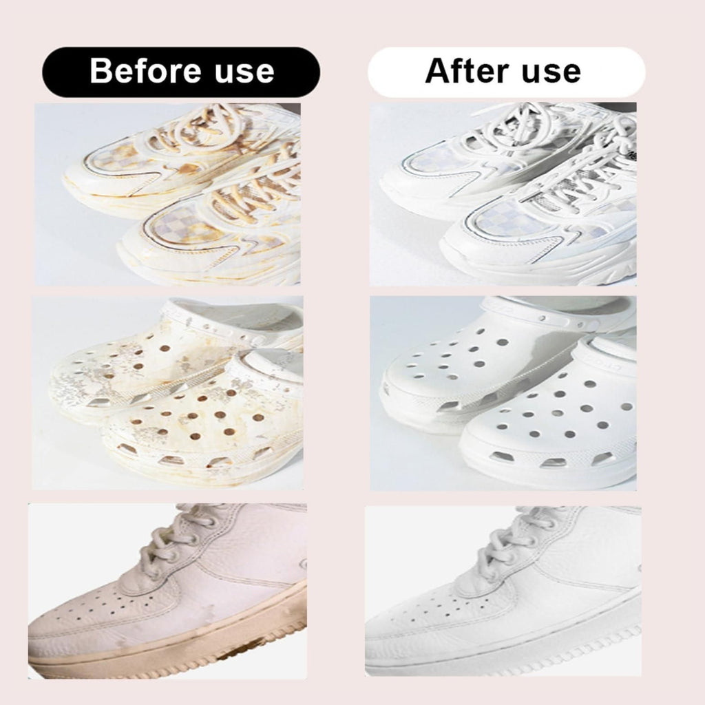 Stain Removal Wet Wipes (Pack of 10)